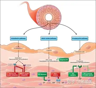 肺动脉高压的药物治疗