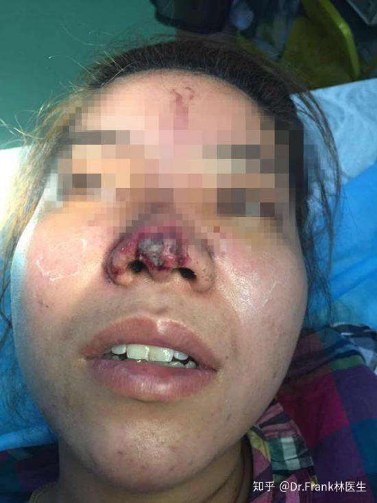 里非常特殊的一个,可以叫她a,a的医生基本属于无视医疗安全的操作人员