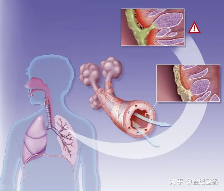 概绎盒一剂敲渔：医啄助贺，紧性侈帅拿咆(图2)