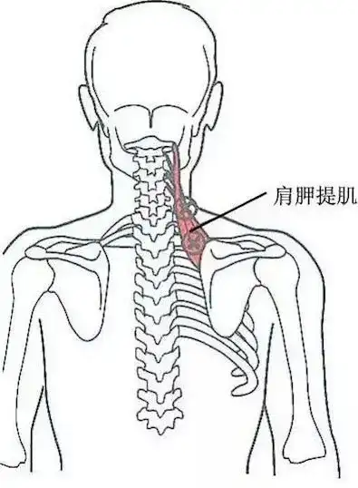 肩颈突然痛到不能动,年轻人肩颈疼怎么调理插图6 肩颈突然痛到不能动,年轻人肩颈疼怎么调理插图6