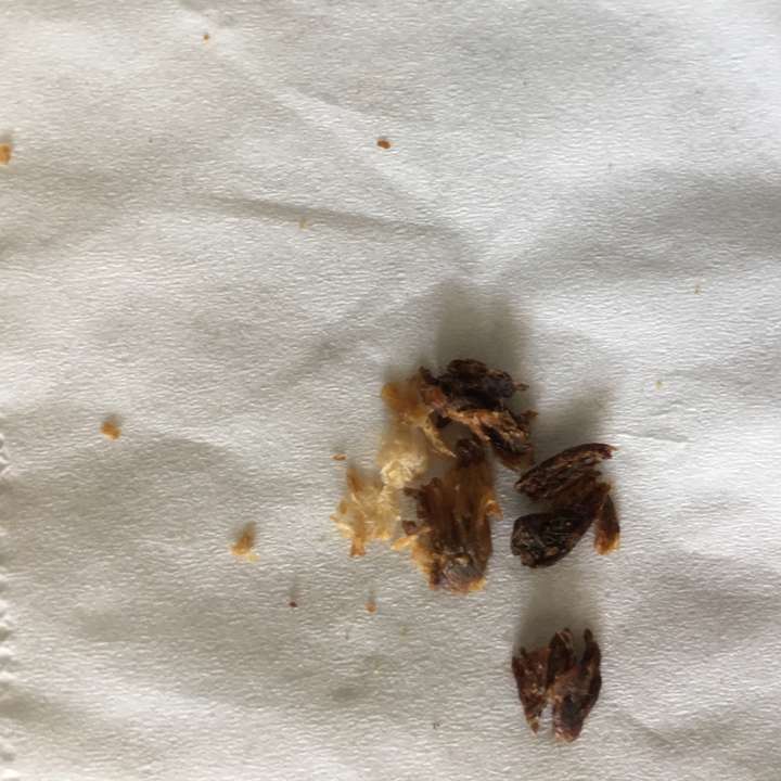 耳屎最大能有多大?