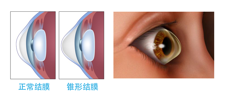 忍不住揉眼 结膜炎就这么来的 知乎