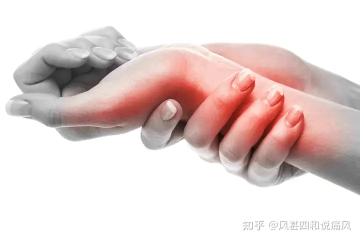 一分钟自测：3个方法测试痛风-自己如何测试