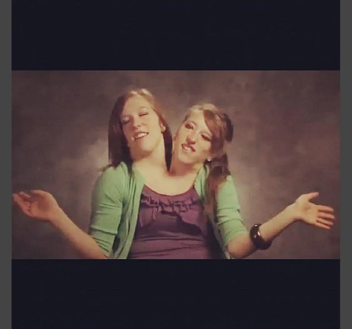 Abby and Brittany Hensel: Conjoined Twins Tour London! Sightseeing Q&A, Conjoined  Twins