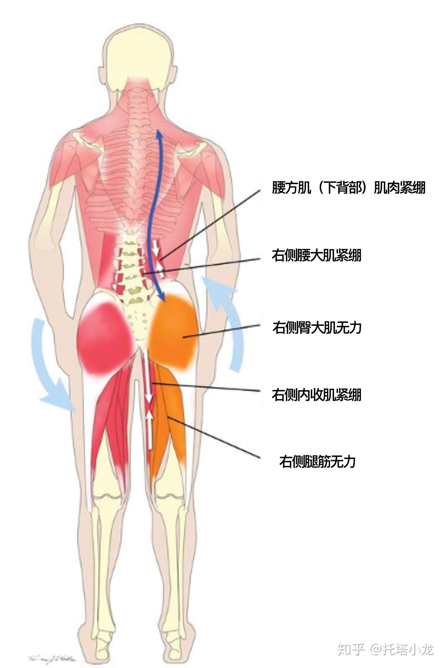 背部肌肉功能障碍及自我评估方法 知乎