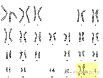 形成xxy染色体可能有哪些情况? - 知乎