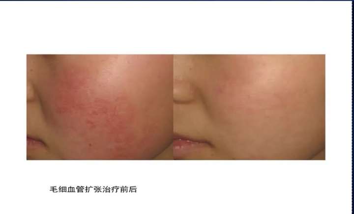 医美的效果强大到真的会上瘾(图16) 医美的效果强大到真的会上瘾(图16)