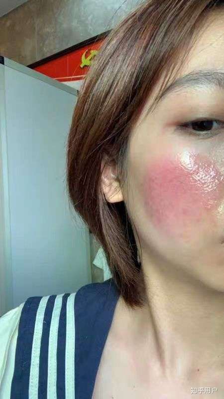 我自己的好歹也是医科大学毕业的! 怎么就不相信我呢!