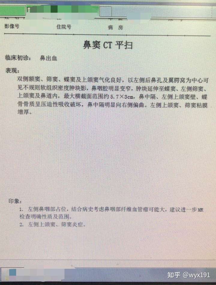 当时我还在读硕士,有天晚上急诊来了一个连夜从河北赶过来的鼻出血的