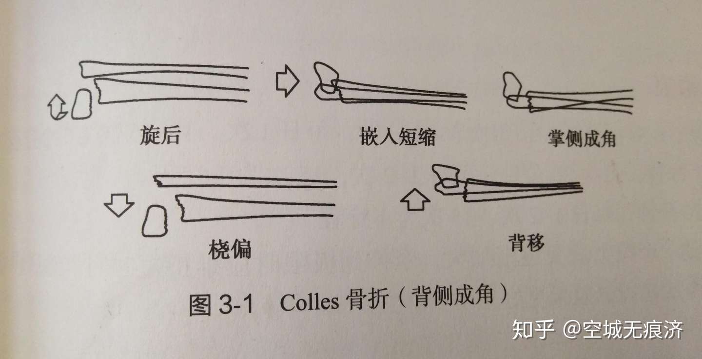 肌肉骨骼康复学 知乎