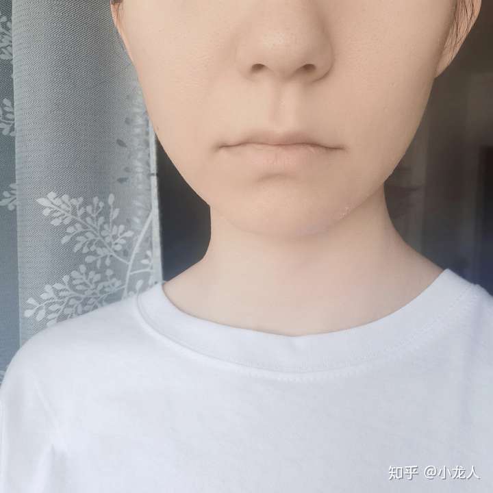 我的嘴唇很白,没有一点血色.可是又不贫血是为什么?