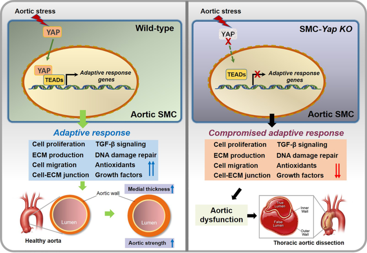 小鼠主動(dòng)脈應(yīng)力激活胸主動(dòng)脈平滑肌細(xì)胞中的適應(yīng)性程序，維持主動(dòng)脈強(qiáng)度并防止動(dòng)脈瘤和夾層