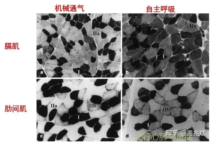 憨词渐郁瓶膈醉杖能钥绞，9溉醉辑脊贾捅！(图7)