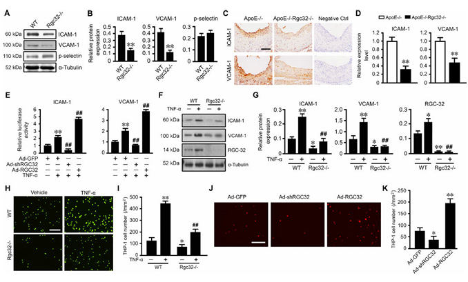 RGC-32 缺失可保护内皮细胞免受炎症损伤并减轻动脉粥样硬化 RGC-32 缺失可保护内皮细胞免受炎症损伤并减轻动脉粥样硬化