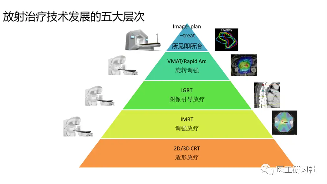 到底什么才算是在线自适应放疗？ - 知乎