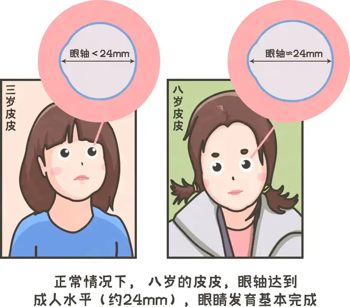 【眼健康科普课堂】为什么砸多少钱都治不好近视？(图6)