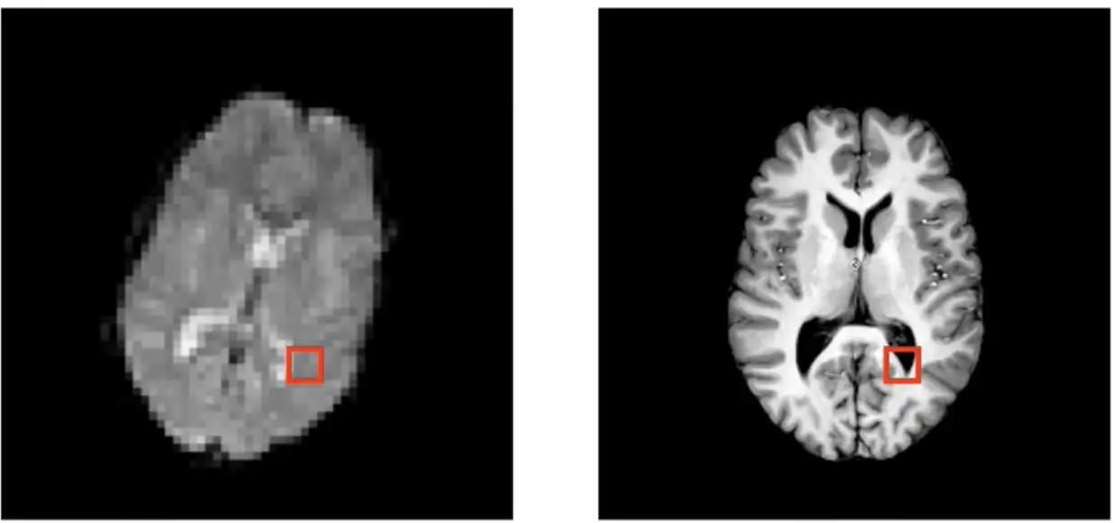 MATLAB图像配准详解:图像对齐与融合的艺术,打造完美图像