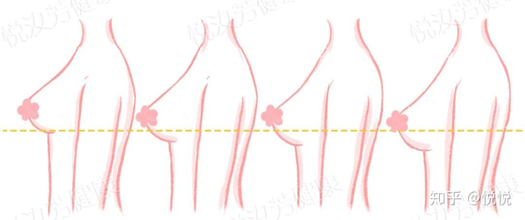 胸型 史上最全胸型科普合集 拿走不谢 知乎