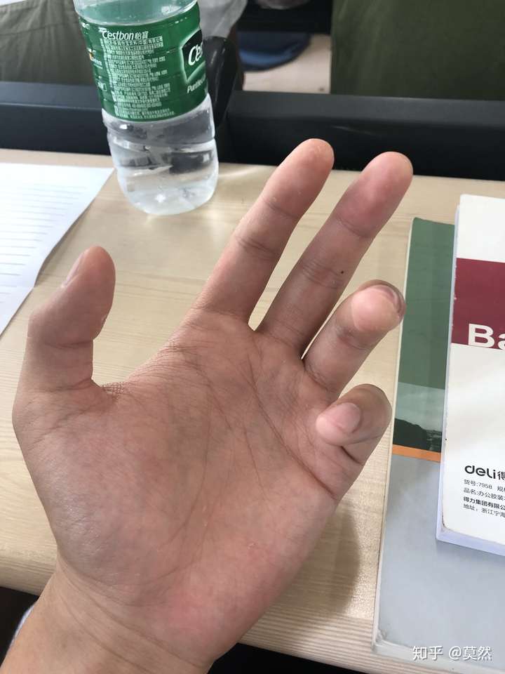 大家弹吉他的手指都是什么样的