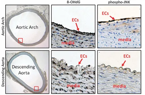 紊亂血流誘導(dǎo)自噬并損傷自噬流以擾亂線粒體穩(wěn)態(tài)