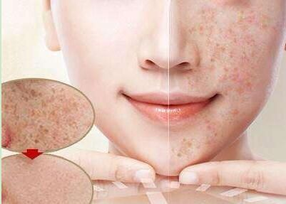 皮肤的好坏对颜值的改变有多大?