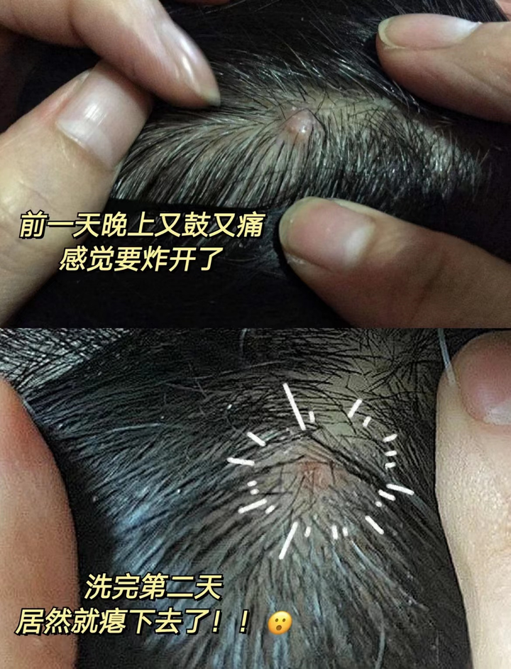 洗發(fā)水推薦排行榜 | 超全深度測評熱門洗發(fā)水：除菌祛痘、去屑止癢、控油蓬松、防脫養(yǎng)發(fā)？最強王者毫無懸洗發(fā)