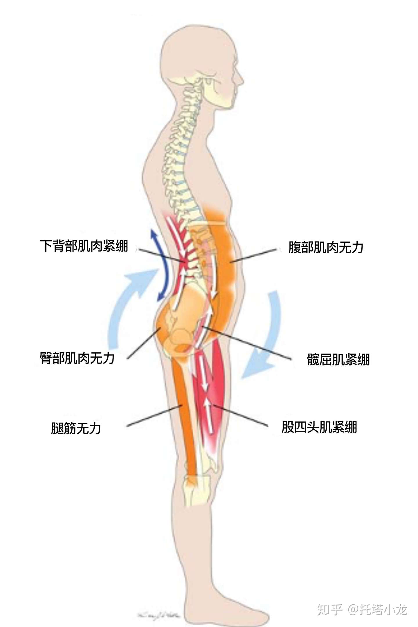 背部肌肉功能障碍及自我评估方法 知乎