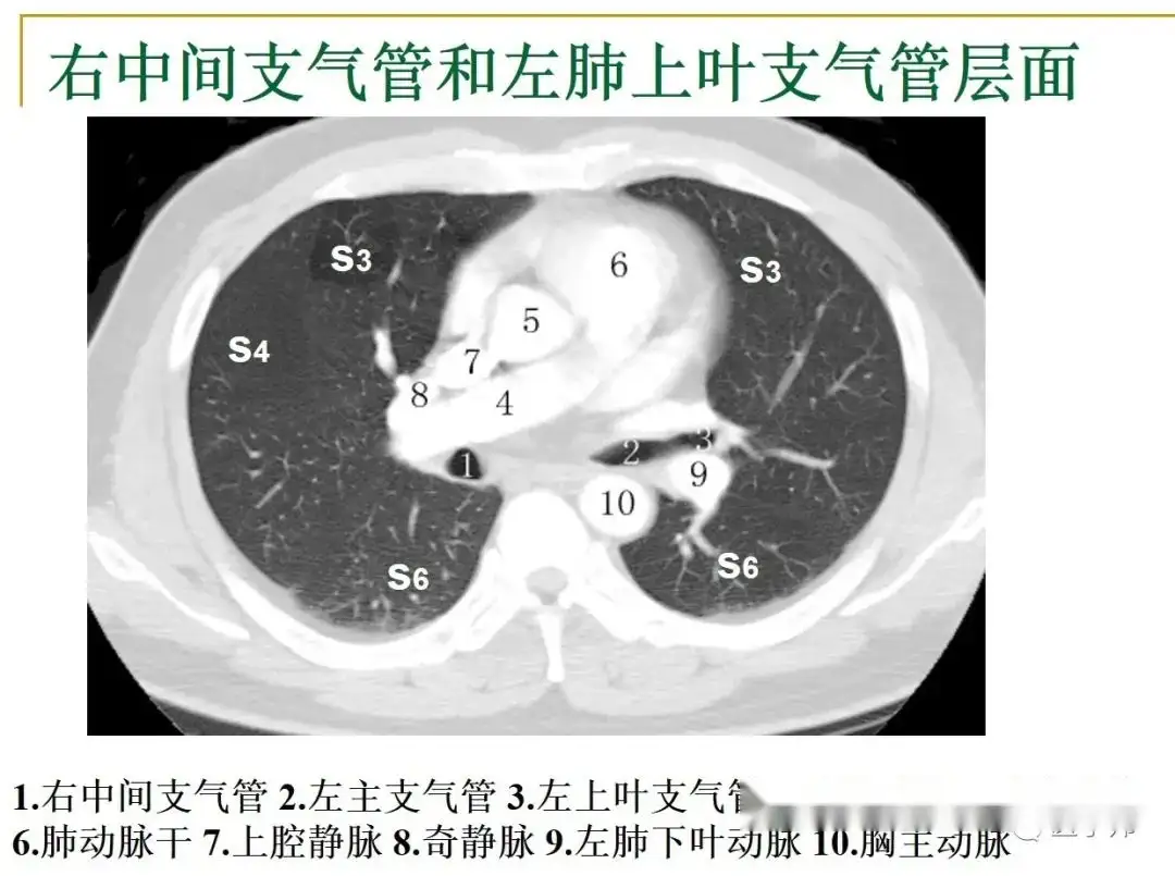 胸部CT读片技巧汇总- 知乎