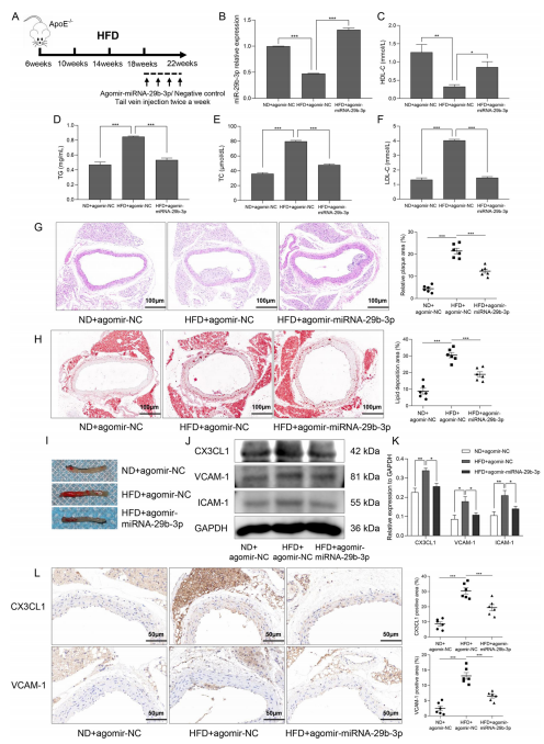 層流剪切應力通過調控 miR - 29b - 3p/CX3CL1 軸減輕單核細胞黏附及動脈粥樣硬化發展 層流剪切應力通過調控 miR - 29b - 3p/CX3CL1 軸減輕單核細胞黏附及動脈粥樣硬化發展