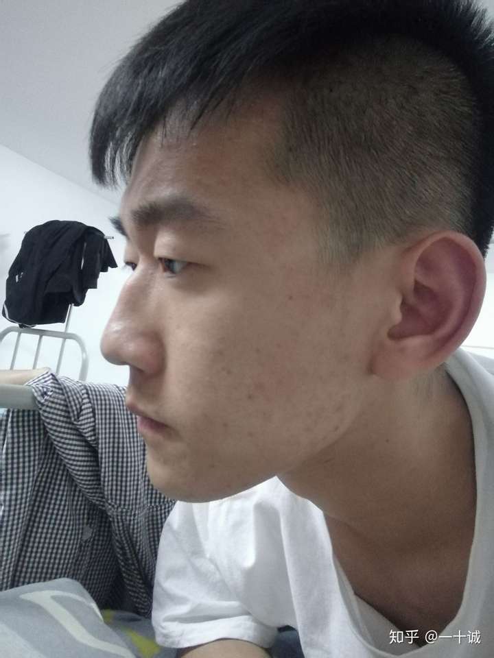 山根低鼻梁高是怎样的体验?