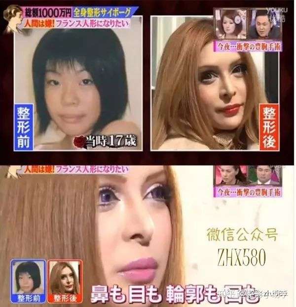整容上瘾之路 是为了遇见更好的自己 还是一种自我迷失 知乎