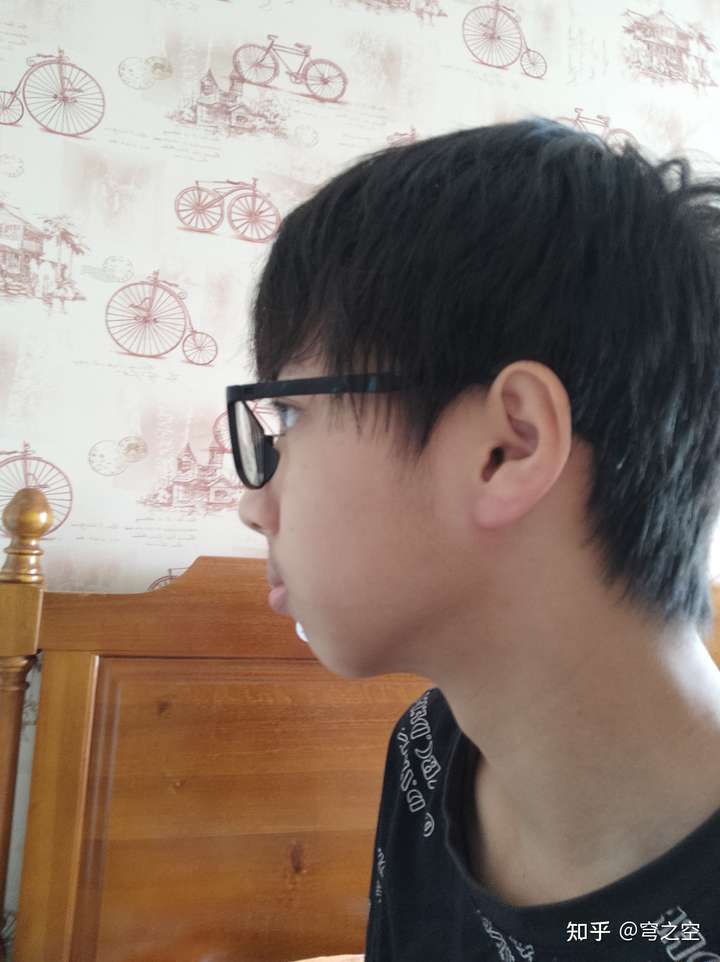 侧脸丑而正脸好看是一种什么体验?