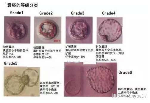 囊胚移植成功率多少 主要由胚胎质量等级决定 知乎