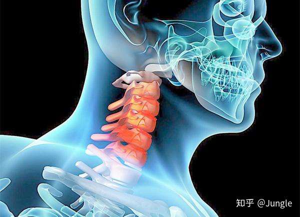 颈椎病和腰间盘突出最佳治疗方法分享 我对抗骨病一路以来真实的经验总结 知乎