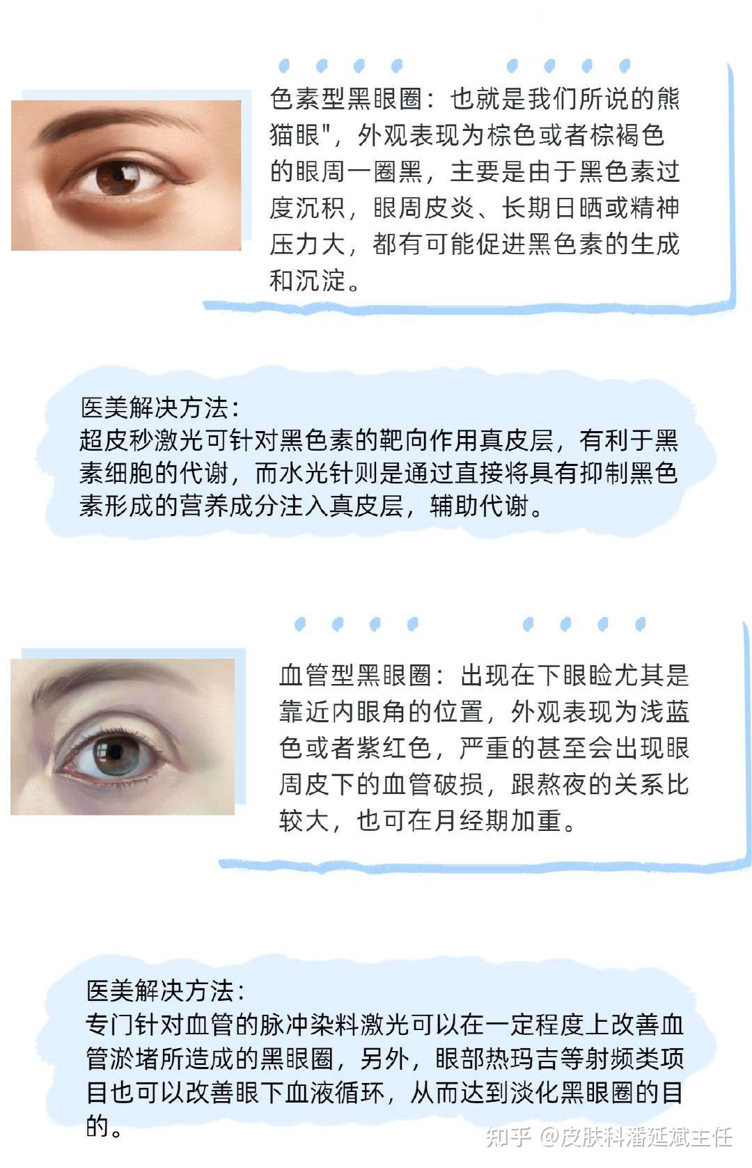眼部衰老严重 学会这几招魅力电眼不是梦 知乎
