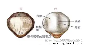 髌骨脱位症状图片