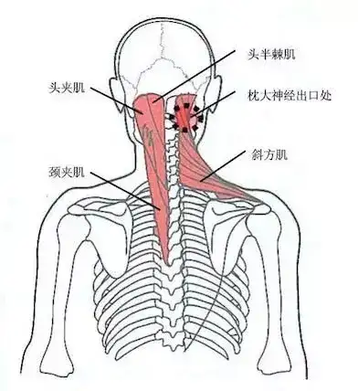 肩颈突然痛到不能动,年轻人肩颈疼怎么调理插图2 肩颈突然痛到不能动,年轻人肩颈疼怎么调理插图2