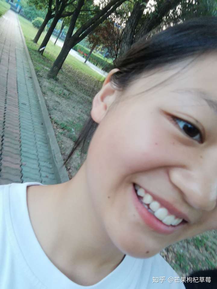 你见过蒜头鼻的美女吗?