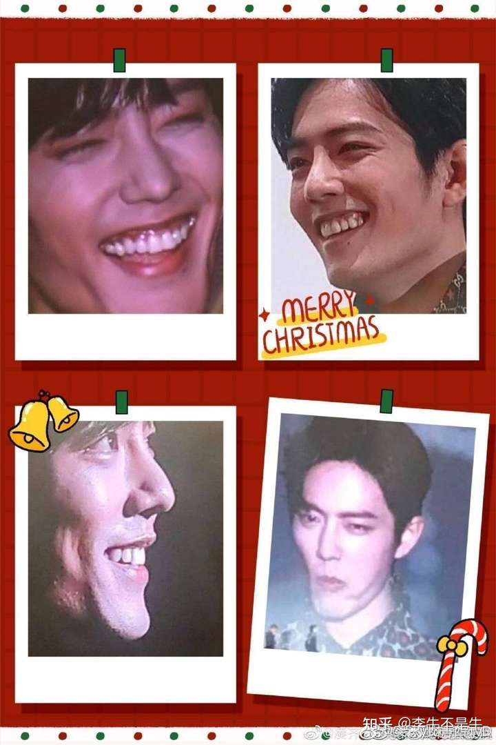 脸整的都快垮了,颧骨跟什么奇行种似的,眼睑下至做得痕迹太明显了