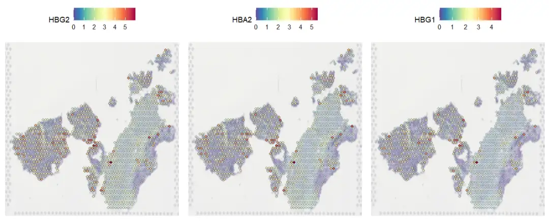 空间转录组|Load10X_Spatial函数修改适配多形式数据+ 空转标准流程- 知乎