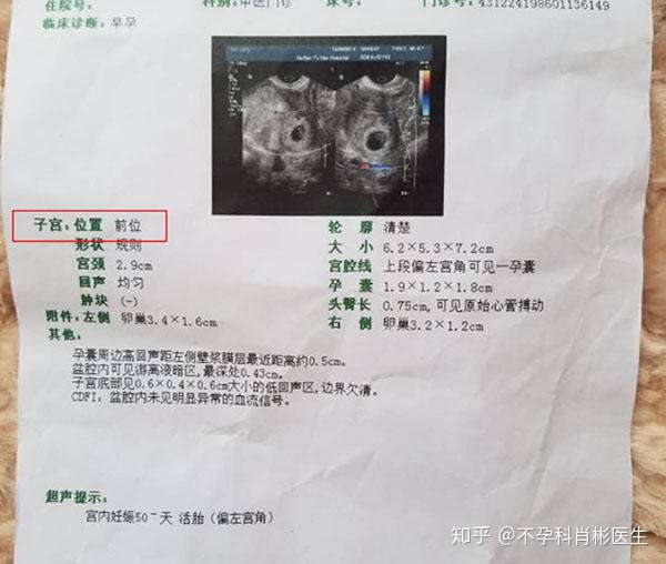 子宫前位与子宫后位 教你如何分清 知乎