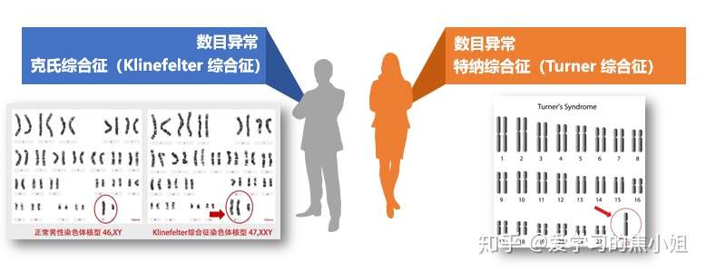 不孕不育是遗传病吗 系列话题 上篇 知乎