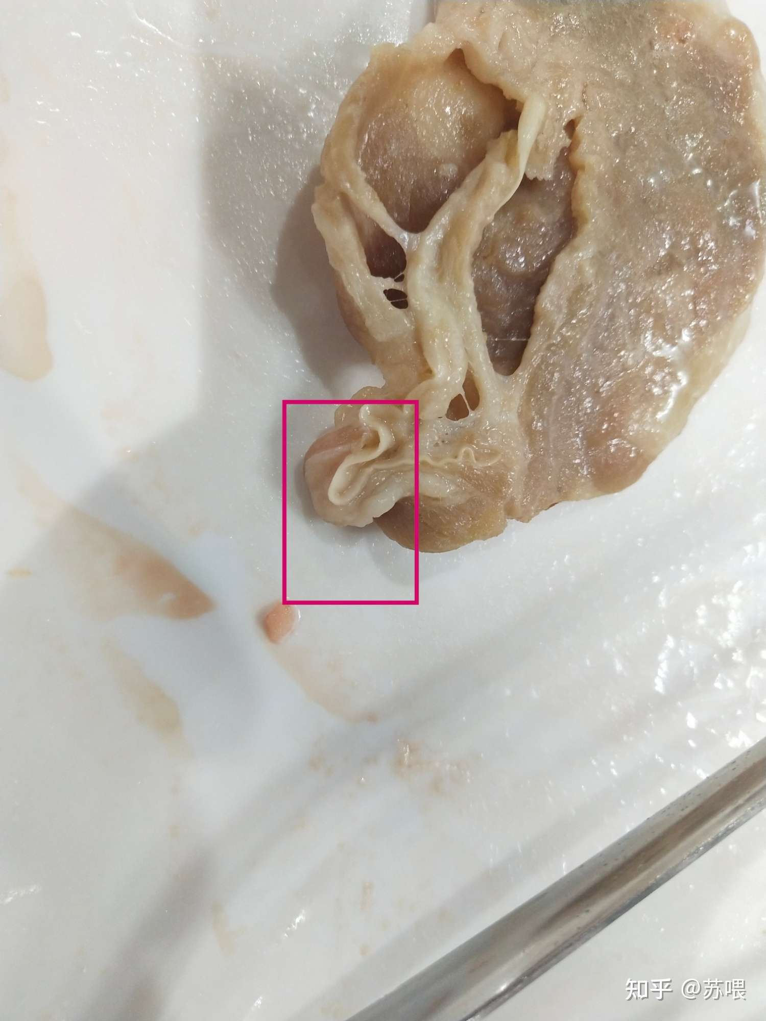 猪肉绦虫囊蚴结节图片