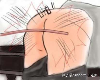 在新加坡被鞭刑是什么感受