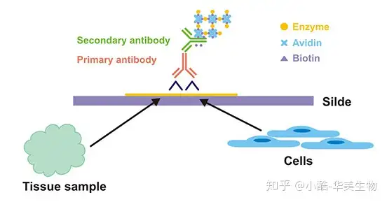 免疫组化（IHC）与病理诊断- 知乎