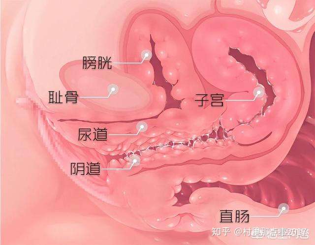 为什么女人容易得尿路感染 知乎