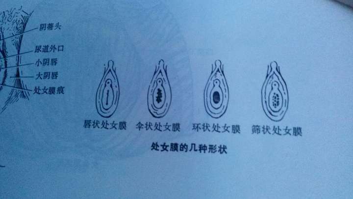 处女膜是分形状的. 有图…………有真相