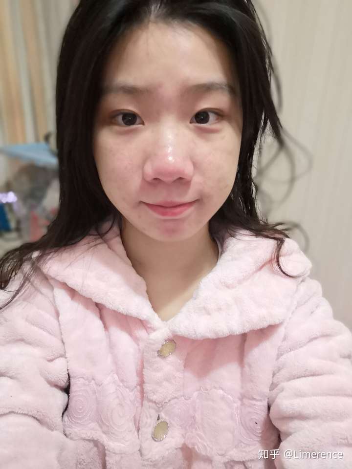 鼻子大真的很难看吗?