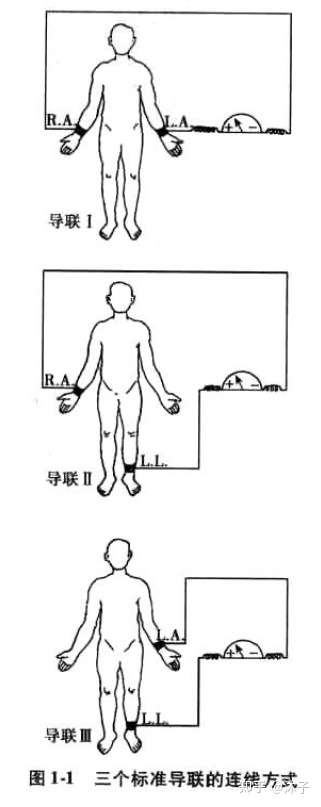 心电图之12导联介绍整理 知乎