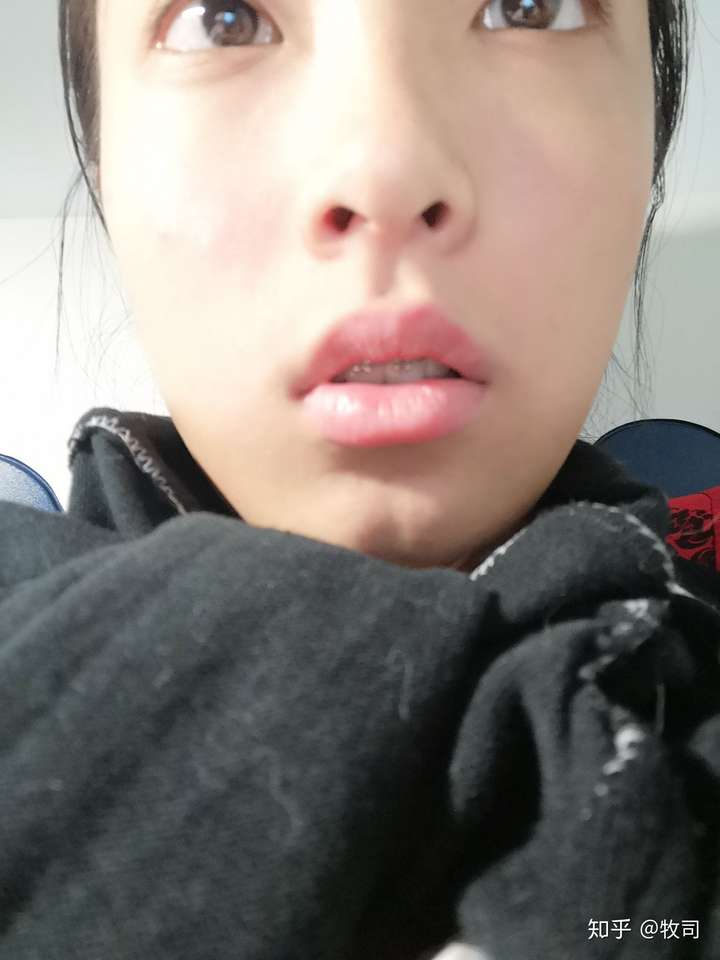 感觉好了很多 但是依旧歪 现在感觉自己人中都是歪的 展开阅读全文